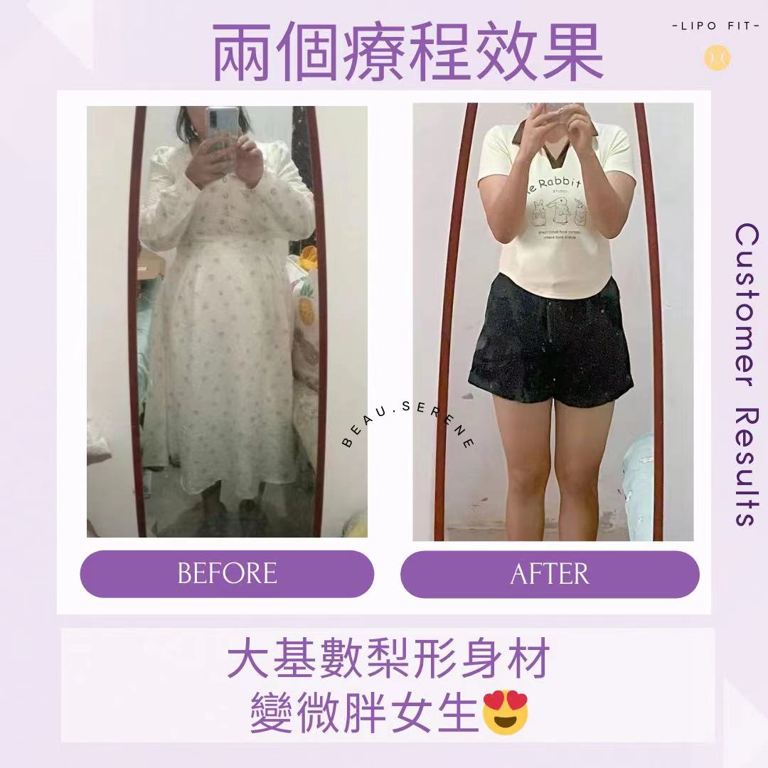 顧客效果：兩個療程效果～大基數梨形女孩變微胖女生！